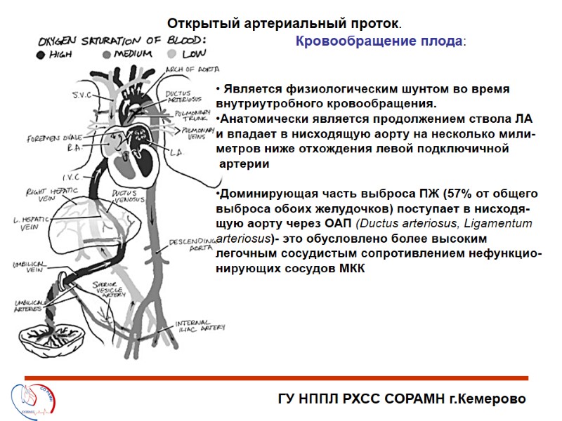 ГУ НППЛ РХСС СОРАМН г.Кемерово Открытый артериальный проток.  Является физиологическим шунтом во время